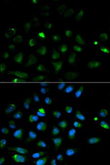 PRF1 / Perforin Antibody - Immunofluorescence analysis of HeLa cells using PRF1 antibody. Blue: DAPI for nuclear staining.