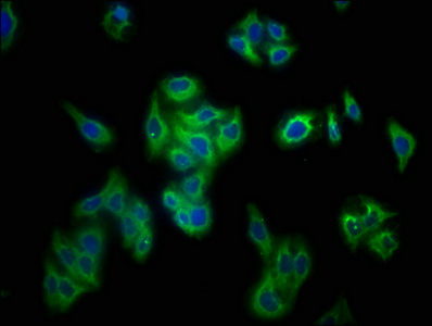 PRF1 / Perforin Antibody - Immunofluorescence staining of HepG2 cells with Prf1 Antibody at 1:133, counter-stained with DAPI. The cells were fixed in 4% formaldehyde, permeabilized using 0.2% Triton X-100 and blocked in 10% normal Goat Serum. The cells were then incubated with the antibody overnight at 4°C. The secondary antibody was Alexa Fluor 488-congugated AffiniPure Goat Anti-Rabbit IgG(H+L).