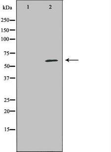 PRF1 / Perforin Antibody - Western blot analysis of K562 whole cells lysates using PRF1 antibody. The lane on the left is treated with the antigen-specific peptide.