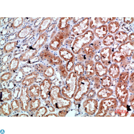 PRF1 / Perforin Antibody - Immunohistochemical analysis of paraffin-embedded human-kidney, antibody was diluted at 1:200.