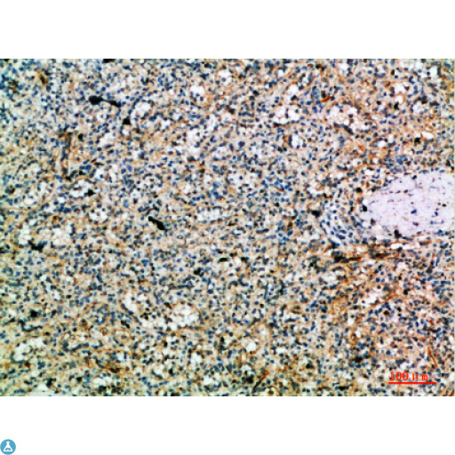 PRF1 / Perforin Antibody - Immunohistochemical analysis of paraffin-embedded human-spleen, antibody was diluted at 1:200.
