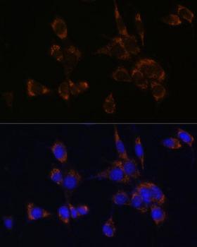 PRF1 / Perforin Antibody - Immunofluorescence analysis of NIH/3T3 cells using Perforin Polyclonal Antibody at dilution of 1:100.Blue: DAPI for nuclear staining.