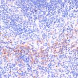 PRF1 / Perforin Antibody - Immunohistochemistry of paraffin-embedded Mouse spleen using Perforin Polyclonal Antibody at dilution of 1:100 (40x lens).