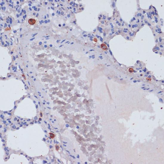 PRF1 / Perforin Antibody - Immunohistochemistry of paraffin-embedded Rat lung using Perforin Polyclonal Antibody at dilution of 1:100 (40x lens).