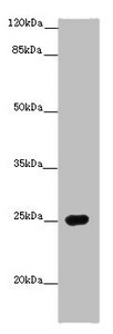 PRG2 / Proteoglycan 2 Antibody - Western blot All Lanes: PRG2 antibody at 14 ug/ml+ Human placenta tissue Secondary Goat polyclonal to rabbit IgG at 1/10000 dilution Predicted band size: 26,24 kDa Observed band size: 25 kDa