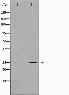 PRG2 / Proteoglycan 2 Antibody - Western blot analysis of MCF-7 cell lysates using PRG2 antibody. The lane on the left is treated with the antigen-specific peptide.