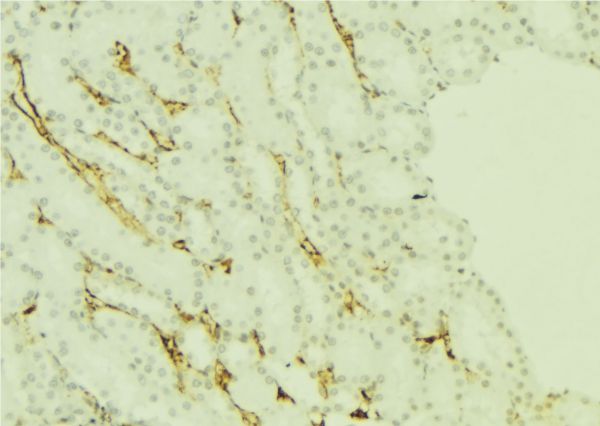 PRG2 / Proteoglycan 2 Antibody - 1:100 staining mouse kidney tissue by IHC-P. The sample was formaldehyde fixed and a heat mediated antigen retrieval step in citrate buffer was performed. The sample was then blocked and incubated with the antibody for 1.5 hours at 22°C. An HRP conjugated goat anti-rabbit antibody was used as the secondary.