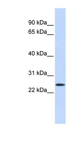 PRGP1 / PRRG1 Antibody - PRRG1 antibody Western blot of Fetal Heart lysate. This image was taken for the unconjugated form of this product. Other forms have not been tested.