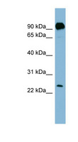 PRGP1 / PRRG1 Antibody - PRRG1 antibody Western blot of THP-1 cell lysate. This image was taken for the unconjugated form of this product. Other forms have not been tested.