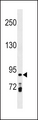 PRICKLE1 Antibody - PRICKLE1 Antibody western blot of MDA-MB453 cell line lysates (35 ug/lane). The PRICKLE1 antibody detected the PRICKLE1 protein (arrow).