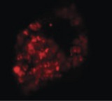 PRICKLE1 Antibody - Immunofluorescence of PRICKLE1 in human bladder cells with PRICKLE1 antibody at 20 ug/ml.