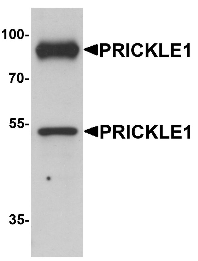 PRICKLE1 Antibody - Western blot analysis of PRICKLE1 in human bladder tissue lysate with PRICKLE1 antibody at 1 ug/ml.