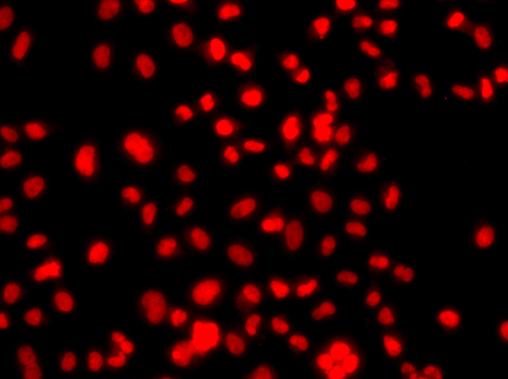 PRICKLE2 Antibody - Immunofluorescence analysis of A549 cells.
