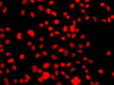 PRICKLE2 Antibody - Immunofluorescence analysis of A549 cells.