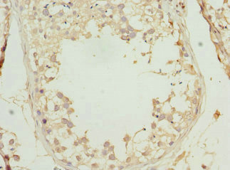 PRICKLE2 Antibody - Immunohistochemistry of paraffin-embedded human testis tissue at dilution 1:100
