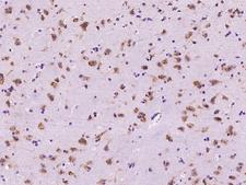 PRICKLE2 Antibody - Immunochemical staining of human PRICKLE2 in human brain with rabbit polyclonal antibody at 1:300 dilution, formalin-fixed paraffin embedded sections.