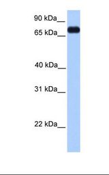 PRICKLE3 / LMO6 Antibody - Transfected 293T cell lysate. Antibody concentration: 1.0 ug/ml. Gel concentration: 12%.  This image was taken for the unconjugated form of this product. Other forms have not been tested.