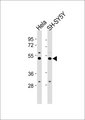 PRIM1 Antibody - All lanes : Anti-PRIM1 Antibody at 1:1000 dilution Lane 1: HeLa whole cell lysates Lane 2: SH-SY5Y whole cell lysates Lysates/proteins at 20 ug per lane. Secondary Goat Anti-Rabbit IgG, (H+L),Peroxidase conjugated at 1/10000 dilution Predicted band size : 50 kDa Blocking/Dilution buffer: 5% NFDM/TBST.