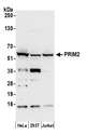 PRIM2 / DNA Primase Antibody - Detection of human PRIM2 by western blot. Samples: Whole cell lysate (50 µg) from HeLa, HEK293T, and Jurkat cells prepared using NETN lysis buffer. Antibody: Affinity purified rabbit anti-PRIM2 antibody used for WB at 0.1 µg/ml. Detection: Chemiluminescence with an exposure time of 30 seconds.