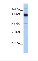 PRKAA1 / AMPK Alpha 1 Antibody - Fetal muscle lysate. Antibody concentration: 1.0 ug/ml. Gel concentration: 12%.  This image was taken for the unconjugated form of this product. Other forms have not been tested.