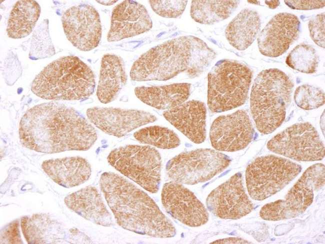 PRKAA1 / AMPK Alpha 1 Antibody - Detection of Human AMPK alpha 1 by Immunohistochemistry. Samples: FFPE section of human skeletal muscle. Antibody: Affinity purified rabbit anti-AMPK alpha 1 used at a dilution of 1:250. Detection: DAB.
