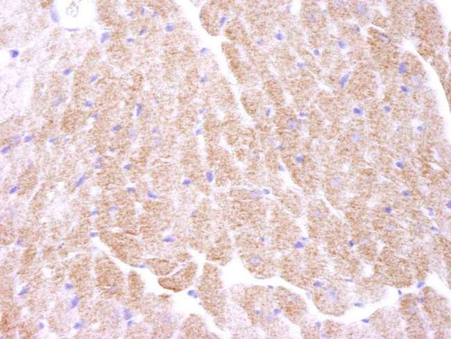 PRKAA1 / AMPK Alpha 1 Antibody - Detection of Mouse AMPK alpha 1 by Immunohistochemistry. Samples: FFPE section of mouse heart. Antibody: Affinity purified rabbit anti-AMPK alpha 1 used at a dilution of 1:250. Detection: DAB.