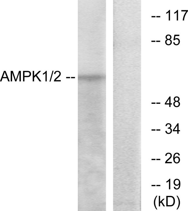PRKAA1 / AMPK Alpha 1 Antibody - Western blot analysis of lysates from HT29 cells, using AMPK1 Antibody. The lane on the right is blocked with the synthesized peptide.
