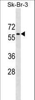 PRKAA1 / AMPK Alpha 1 Antibody - AMPKalpha1 Antibody (C494) western blot of SK-BR-3 cell line lysates (35 ug/lane). The AMPKalpha1 antibody detected the AMPKalpha1 protein (arrow).