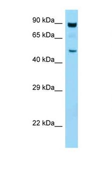 PRKAA1 / AMPK Alpha 1 Antibody - PRKAA1 / AMPK Alpha 1 antibody Western blot of Mouse Thymus lysate. Antibody concentration 1 ug/ml.  This image was taken for the unconjugated form of this product. Other forms have not been tested.