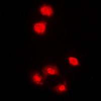 PRKAA1 / AMPK Alpha 1 Antibody - Immunofluorescent analysis of AMPK alpha 1 staining in HeLa cells. Formalin-fixed cells were permeabilized with 0.1% Triton X-100 in TBS for 5-10 minutes and blocked with 3% BSA-PBS for 30 minutes at room temperature. Cells were probed with the primary antibody in 3% BSA-PBS and incubated overnight at 4 deg C in a humidified chamber. Cells were washed with PBST and incubated with a DyLight 594-conjugated secondary antibody (red) in PBS at room temperature in the dark. DAPI was used to stain the cell nuclei (blue).