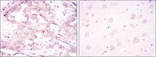 PRKAA1 / AMPK Alpha 1 Antibody - Immunohistochemistry-Paraffin: AMPK alpha 1 Antibody (2B7) - Immunohistochemical analysis of paraffin-embedded ovarian cancer (left) and brain tissues (right) using AMPK alpha 1 mouse mAb with DAB staining.