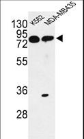 PRKAA1 / AMPK Alpha 1 Antibody - Western blot of PRKAA1 Antibody in K562, MDA-MB435 cell line lysates (35 ug/lane). PRKAA1 (arrow) was detected using the purified antibody.