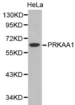 PRKAA1 / AMPK Alpha 1 Antibody - Western blot of PRKAA1 pAb in extracts from Hela cells.