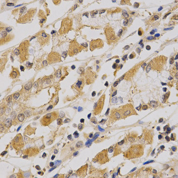 PRKAA1 / AMPK Alpha 1 Antibody - Immunohistochemistry of paraffin-embedded human stomach using PRKAA1 antibody at dilution of 1:200 (x400 lens).
