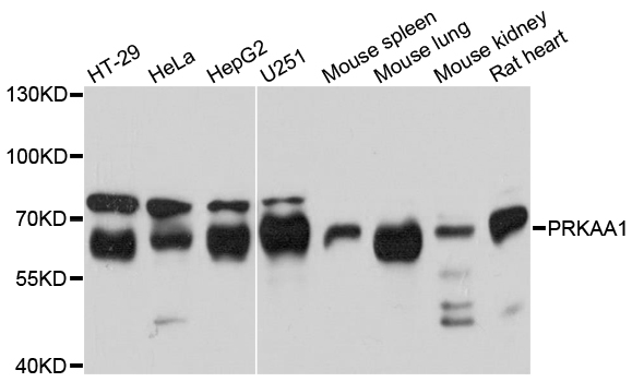 PRKAA1 / AMPK Alpha 1 Antibody - Western blot analysis of extracts of various cell lines, using PRKAA1 antibody at 1:1000 dilution. The secondary antibody used was an HRP Goat Anti-Rabbit IgG (H+L) at 1:10000 dilution. Lysates were loaded 25ug per lane and 3% nonfat dry milk in TBST was used for blocking. An ECL Kit was used for detection and the exposure time was 30s.