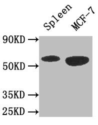 PRKAA1 / AMPK Alpha 1 Antibody - Positive WB detected in:Mouse spleen tissue,MCF-7 whole cell lysate;All lanes: AMPK1 antibody at 3ug/ml;Secondary;Goat polyclonal to rabbit IgG at 1/50000 dilution;Predicted band size: 65,66 kDa;Observed band size: 65 kDa;
