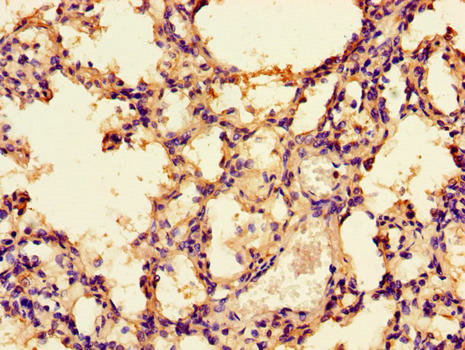 PRKAA1 / AMPK Alpha 1 Antibody - Immunohistochemistry of paraffin-embedded human lung tissue using PRKAA1 Antibody at dilution of 1:100