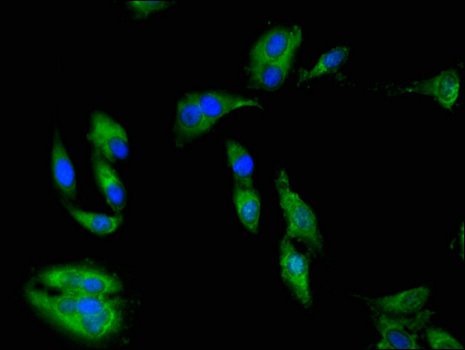 PRKAA1 / AMPK Alpha 1 Antibody - Immunofluorescent analysis of Hela cells using PRKAA1 Antibody at a dilution of 1:100 and Alexa Fluor 488-congugated AffiniPure Goat Anti-Rabbit IgG(H+L)