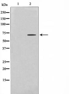 PRKAA1 / AMPK Alpha 1 Antibody - Western blot analysis of AMPK alpha expression in Adriamycin treated COS7 whole cells lysates. The lane on the left is treated with the antigen-specific peptide.