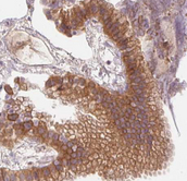 PRKAA1 / AMPK Alpha 1 Antibody - AMPK1 antibody for IHC in human gallbladder tissue