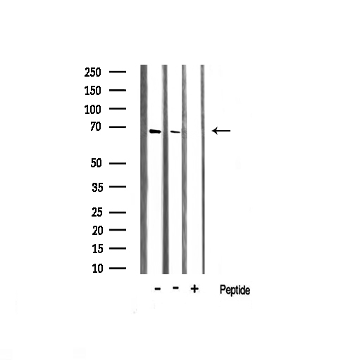 PRKAA1 / AMPK Alpha 1 Antibody - Western blot analysis of AMPK1 expression in various lysates