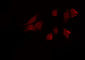 PRKAA1 / AMPK Alpha 1 Antibody - Staining HT29 cells by IF/ICC. The samples were fixed with PFA and permeabilized in 0.1% Triton X-100, then blocked in 10% serum for 45 min at 25°C. The primary antibody was diluted at 1:200 and incubated with the sample for 1 hour at 37°C. An Alexa Fluor 594 conjugated goat anti-rabbit IgG (H+L) Ab, diluted at 1/600, was used as the secondary antibody.