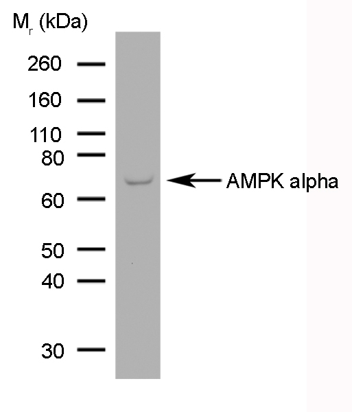 PRKAA1 / AMPK Alpha 1 Antibody - Human brain tumour lysate probed with Mouse anti-AMPK alpha 1/2