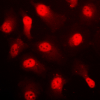 PRKAA1 / AMPK Alpha 1 Antibody - Immunofluorescent analysis of AMPK alpha 1 (pS496) staining in HUVEC cells. Formalin-fixed cells were permeabilized with 0.1% Triton X-100 in TBS for 5-10 minutes and blocked with 3% BSA-PBS for 30 minutes at room temperature. Cells were probed with the primary antibody in 3% BSA-PBS and incubated overnight at 4 C in a humidified chamber. Cells were washed with PBST and incubated with a DyLight 594-conjugated secondary antibody (red) in PBS at room temperature in the dark. DAPI was used to stain the cell nuclei (blue).