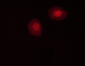PRKAA1 / AMPK Alpha 1 Antibody - Staining C2C12 cells by IF/ICC. The samples were fixed with PFA and permeabilized in 0.1% saponin prior to blocking in 10% serum for 45 min at 37°C. The primary antibody was diluted 1/400 and incubated with the sample for 1 hour at 37°C. A Alexa Fluor 594 conjugated goat polyclonal to rabbit IgG (H+L), diluted 1/600 was used as secondary antibody.
