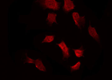 PRKAA1 / AMPK Alpha 1 Antibody - Staining 293 cells by IF/ICC. The samples were fixed with PFA and permeabilized in 0.1% Triton X-100, then blocked in 10% serum for 45 min at 25°C. The primary antibody was diluted at 1:200 and incubated with the sample for 1 hour at 37°C. An Alexa Fluor 594 conjugated goat anti-rabbit IgG (H+L) Ab, diluted at 1/600, was used as the secondary antibody.