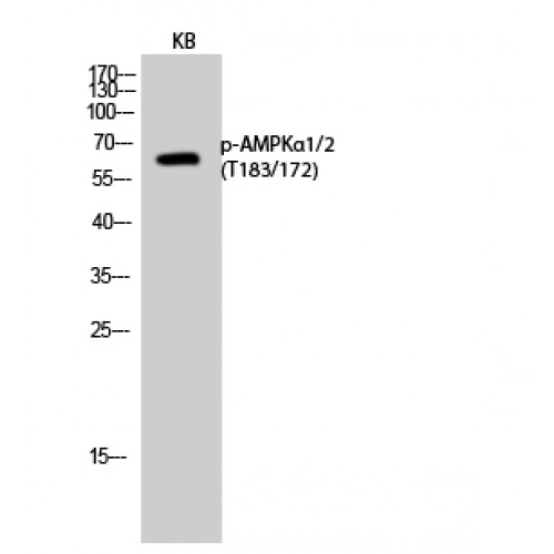 PRKAA1 + PRKAA2 Antibody - Western blot of Phospho-AMPKalpha1/2 (T183/172) antibody
