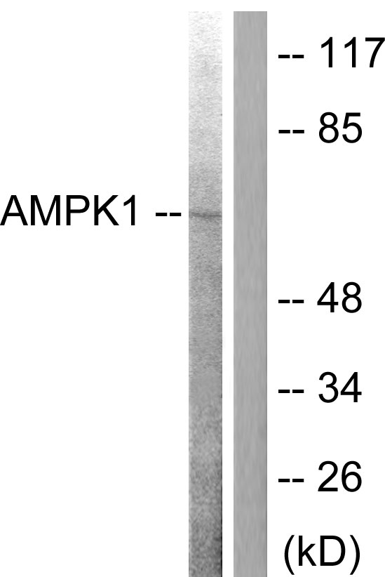 PRKAA1 + PRKAA2 Antibody - Western blot analysis of lysates from COS7 cells, treated with Adriamycin 0.5ng/ml 24h, using AMPK alpha Antibody. The lane on the right is blocked with the synthesized peptide.
