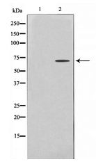 PRKAA1 + PRKAA2 Antibody - Western blot of AMPK alpha expression in Adriamycin treated COS7 whole cell lysates,The lane on the left is treated with the antigen-specific peptide.