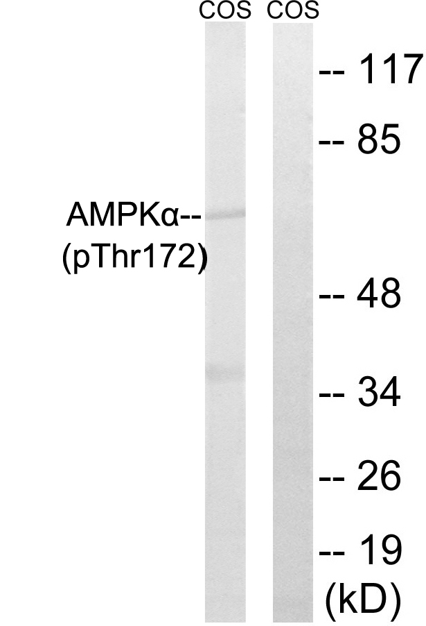 PRKAA1 + PRKAA2 Antibody - Western blot analysis of lysates from COS7 cells, using AMPK alpha 1/2 (Phospho-Thr183/172) Antibody. The lane on the right is blocked with the phospho peptide.